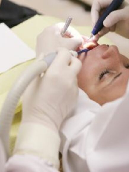 Certificación Experto en Blanqueamiento Dental