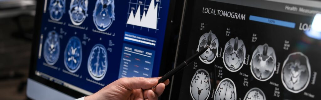 Descubre qué es la neurología.